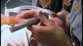 737 Intubation of an Infant [upl. by Sheridan]