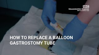 How to replace a balloon Gastrostomy Tube [upl. by Cykana280]