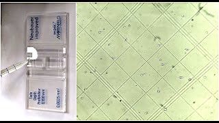 Semen Analysis Test Lab  Sperm Viability Test [upl. by Esilana]