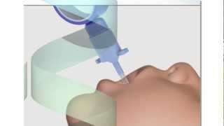 Neonatal Endotracheal Intubation [upl. by Marthe342]