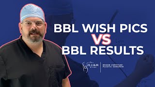 BBL Wish Pics vs BBL Results [upl. by Anahsak544]