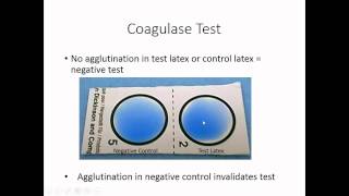 Identification of Staphylococcus [upl. by Bega]