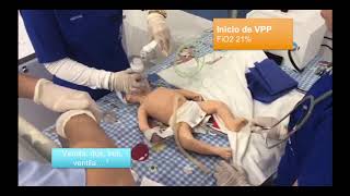 REANIMACION NEONATAL ALGORITMO COMPLETO [upl. by Anavrin]