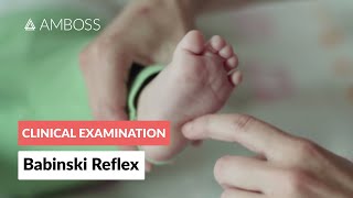 Babinski Reflex in Infants  Clinical Examination [upl. by Haseena]