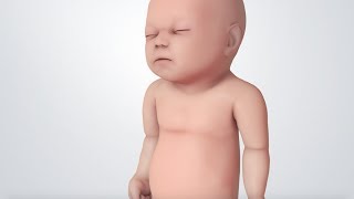 Infant Distress Warning Signs Grunting Baby Sound [upl. by Hsoj]