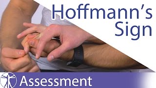 Hoffmanns Sign or Reflex  Upper Motor Neuron Lesion [upl. by Gordan]