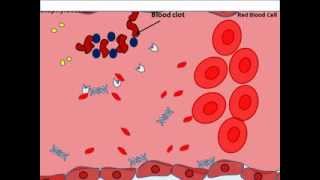 Staphylocccus aureus virulence factors [upl. by Anabella]