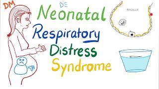 Neonatal Respiratory Distress Syndrome NRDS  Pediatrics  Pulmonology [upl. by Flanagan]